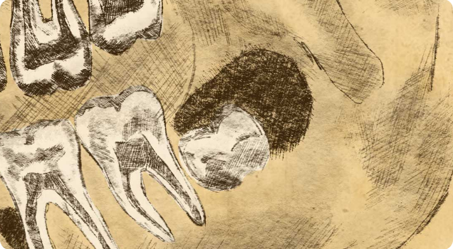 leistungen Zystenentfernung