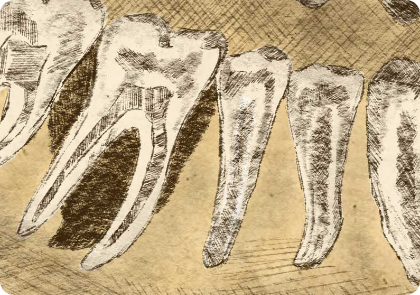 leistungen entfernung von nicht erhaltungswuerdigen Zaehnen