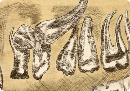 leistungen entfernung von verlagerten Zaehnen