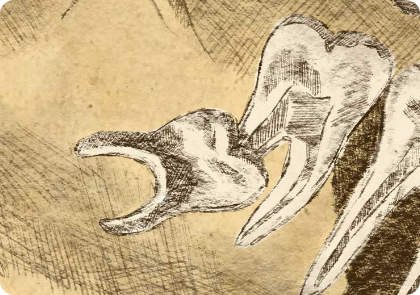 leistungen weisheitszahnentfernung